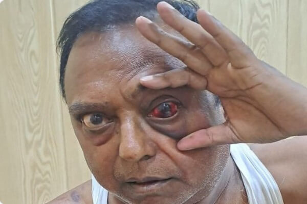 आरयूआईडीपी  सहायक अभियंता जगनलाल बैरवा ने जयदीप बिहाणी और समर्थकों पर पिटाई करने और जातिसूचक गालियां देने का लगाया आरोप