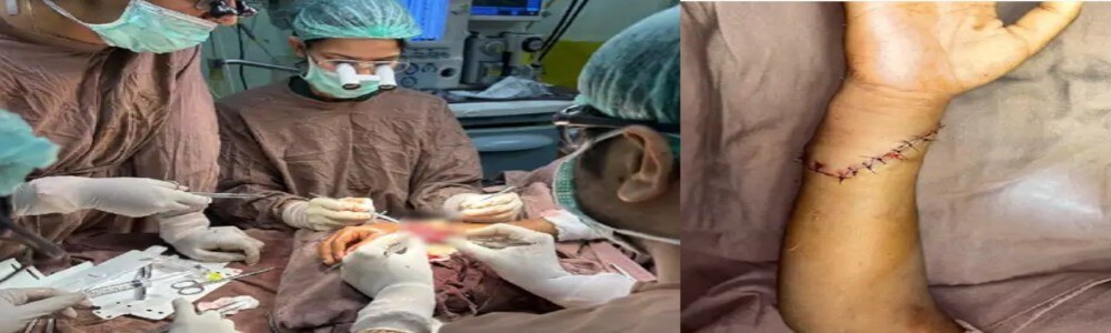 एसएमएस अस्पताल में 6 साल के बच्चे का कटा हाथ सर्जरी कर जोड़ा, डॉक्टर्स बोले- हाथ में जल्द आएगी मूवमें